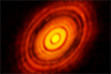 Best image of a newly-forming planet system